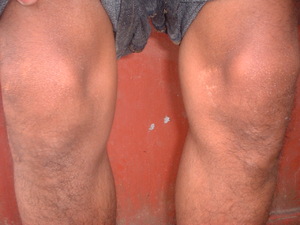 Picture of buel
