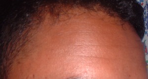 Picture of buked