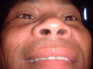 Picture of egbekal