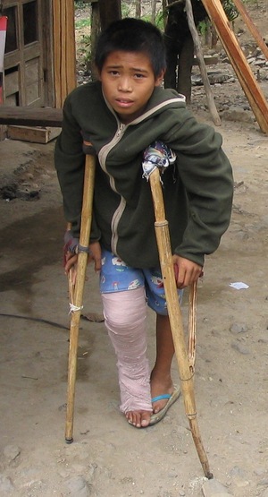 Picture of egkalepuan