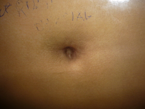 Picture of pused