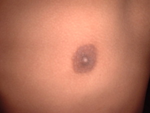 Picture of susu
