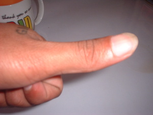 Picture of timbebakal