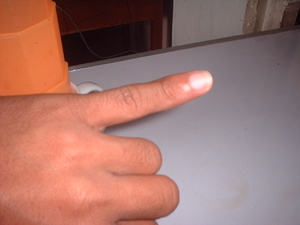 Picture of tindiriisek